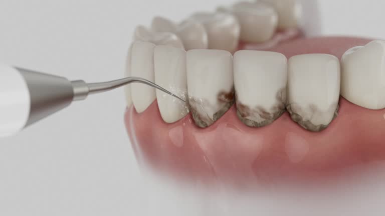 Trusted Teeth Cleaning And Checkup service in Olla, LA - Dentist Open Now